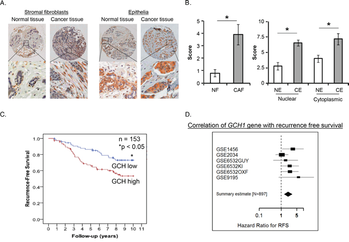 Prognostic significance of GTPCH expression in breast cancer patients.