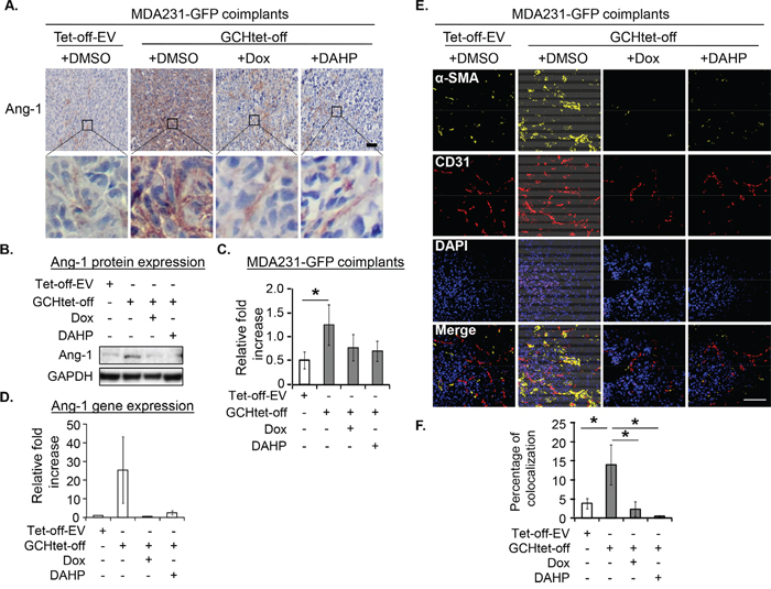 GTPCH expressing fibroblasts increases Ang-1 expression and vessel normalization in breast cancer mouse xenografts.