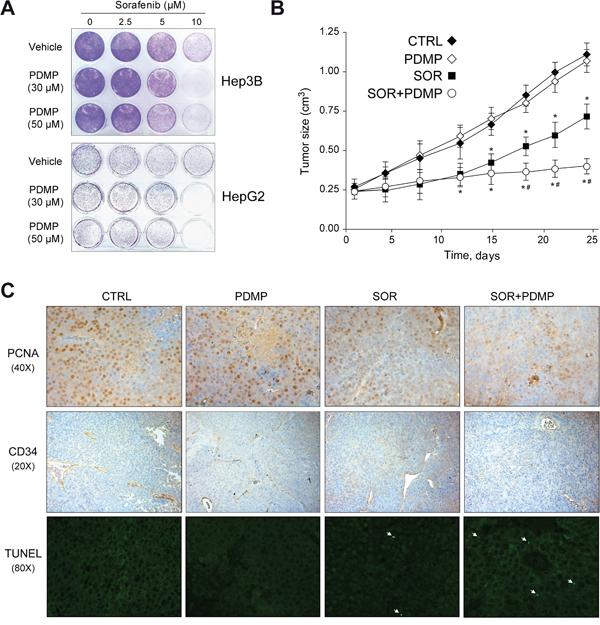 GCS inhibition reduces subcutaneous tumor growth in mouse.