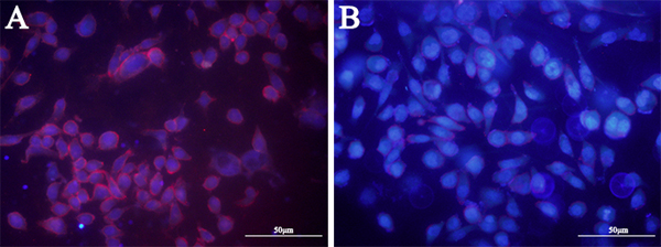 Treatment of proteinase K disrupts binding signal of aptamer LY-1 on the surface of HCC.