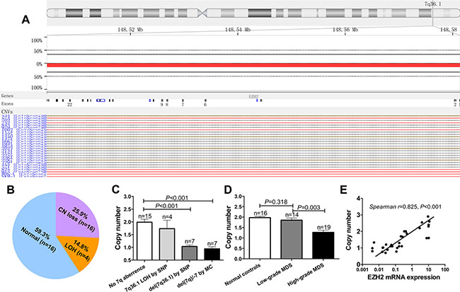 SNP and real-time quantitative PCR reveal lower EZH2 CN in MDS.