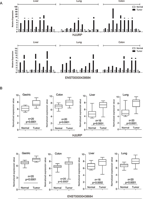 qRT-PCR validation of lncRNA and mRNA expression in samples from external patients.