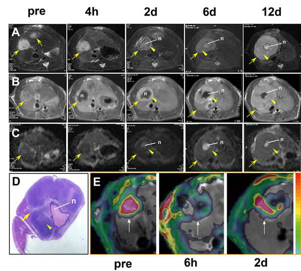 Imaging of tumor resistance to vascular disrupting agents in a rat liver tumor model.