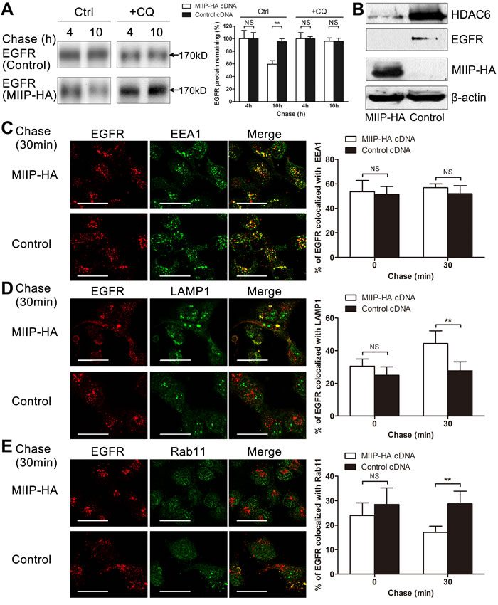 MIIP accelerates lysosomal degradation of mature EGFR.