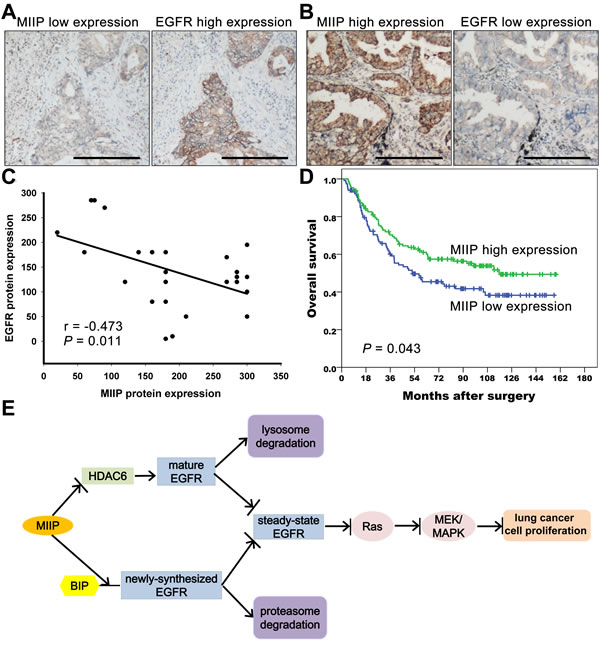 MIIP protein expression correlates negatively with EGFR protein expression in lung adenocarcinoma specimens and predicts patients&#x2019; survivals.