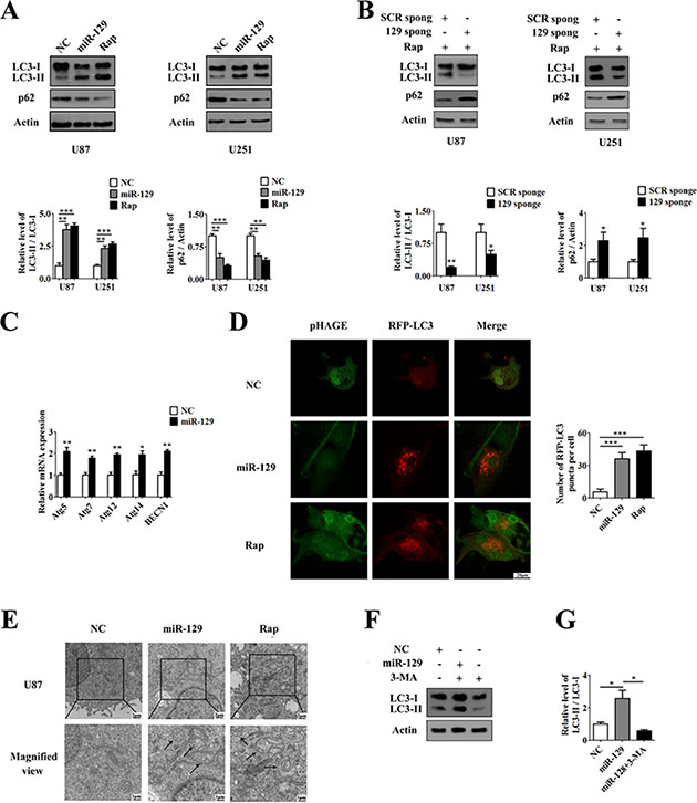 Overexpression of miR-129 induces autophagy in human glioma cells.