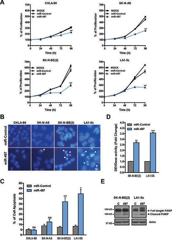 MiR-497 overexpression reduces proliferation of chemoresistant NB cells and induces apoptosis in MYCN-amplified NB cells.