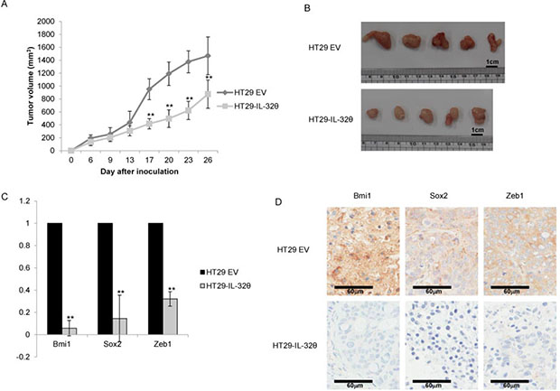 IL-32&#x03B8; inhibits the tumorigenic ability of HT-29 cells in vivo.