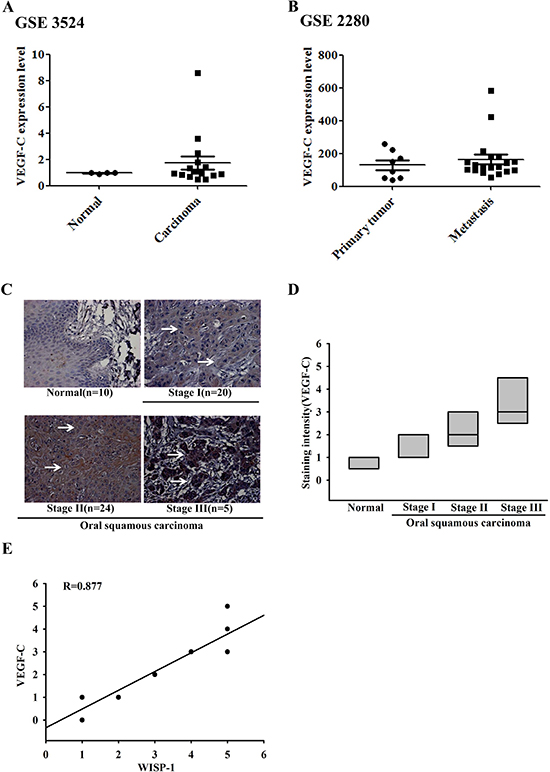 Clinical significance of WISP-1 and VEGF-C in specimens from patients with OSCC.