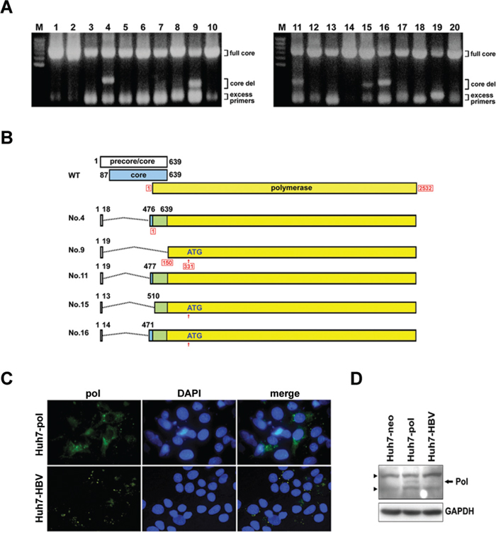 Identification of LFCDs in HCC patients and subcellular localization of HBV polymerase.