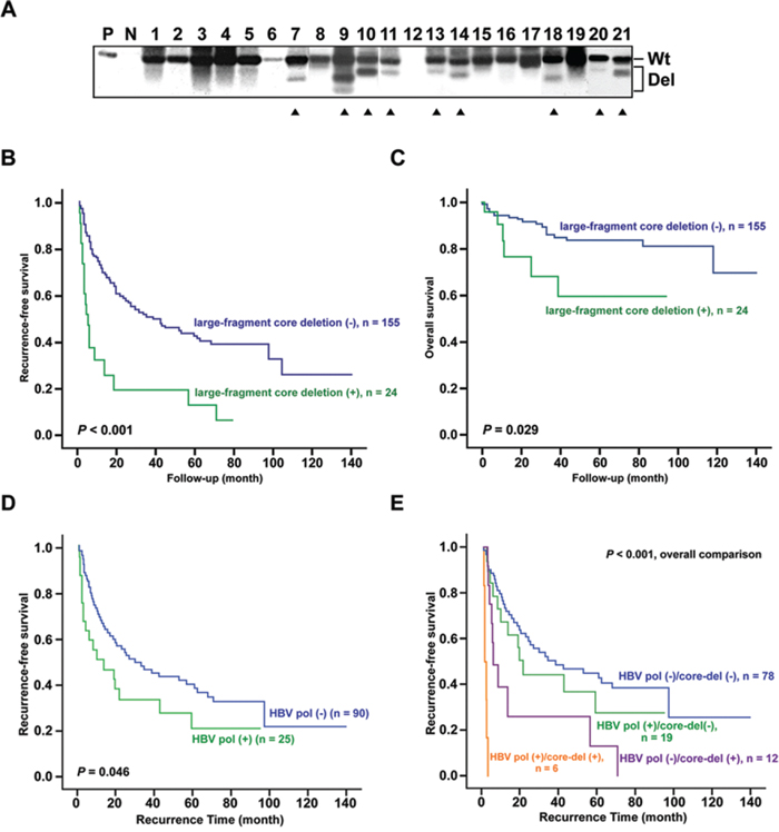 Association between postoperative survivals and HCC patients carrying LFCDs with or without hepatic HBV polymerase antigen expression.