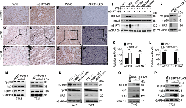 SIRT1 upregulated p-p38 in mouse livers and HCC cells.