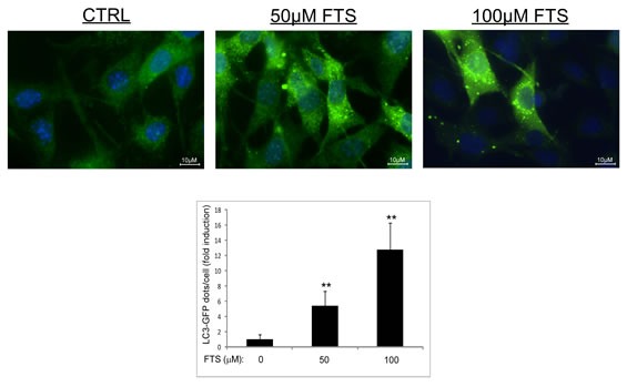 LC3-GFP expression in MEFs.