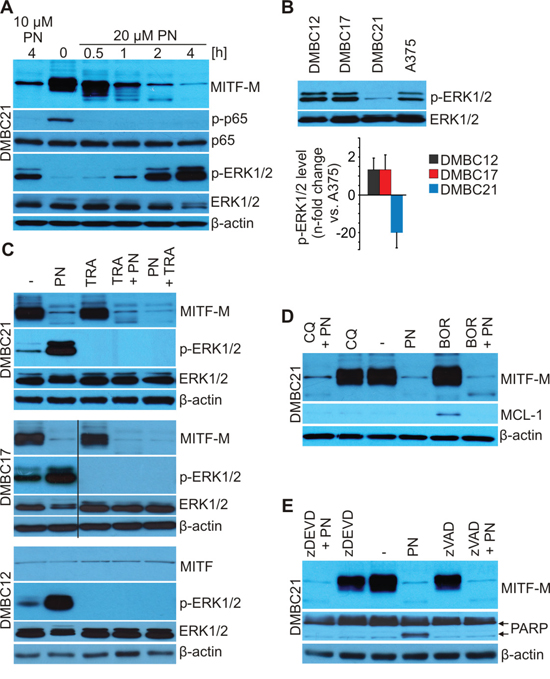 PN does not induce lysosomal, proteasomal and caspase-dependent degradation of MITF-M as shown by immunoblotting.