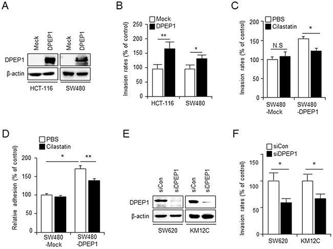 DPEP1 promotes colon cancer cell invasion and adhesion.