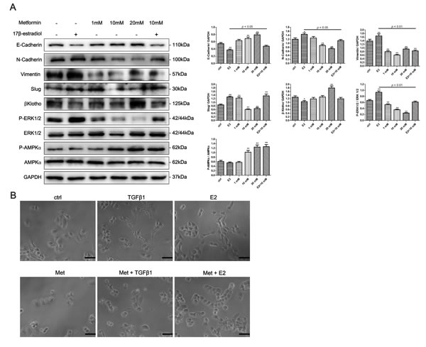 Metformin reverses 17&#x3b2;-estradiol-induced EMT in Ishikawa cells involving &#x3b2;Klotho expression, ERK1/2 and AMPK&#x3b1; signaling pathways.
