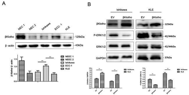 &#x3b2;Klotho expression inhibits ERK1/2 signaling pathway in endometrial cancer cells.