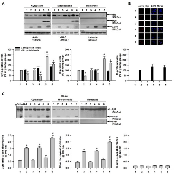 Reduction of free mitochondrial nHb levels by formation of nHb-&#x3b1;-syn complex in cultured dopaminergic cells.