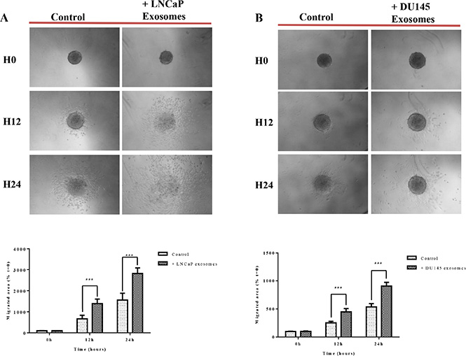 Exosomes increase RWPE-1 cell migration on collagen (I) RWPE-1 spheroids were incubated for 48 hours with exosomes (100 &#x03BC;g/ml) derived from (A) LNCaP, (B) DU145 cells or corresponding serum-free medium and transferred to microwells coated with type I collagen.