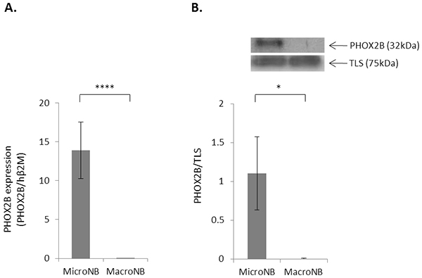PHOX2B expression is higher in MicroNB than in MacroNB cells.