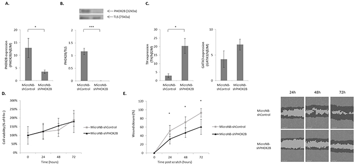 Downregulation of PHOX2B in MicroNB cells affects their malignant phenotype.