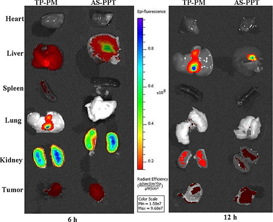Tissue distribution: Localization of Cy3-labeled TP by biophotonic imaging-based analysis after administration of rats with TP-PM and AS-PPT at 6 h and 12 h time point.