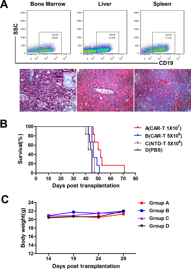 In vivo CAR-T cell treatment in murine B-ALL model.
