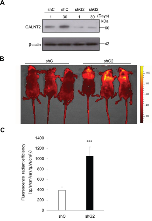 GALNT2 regulates gastric carcinoma cell metastasis in nude mice.