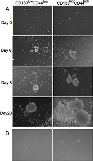 Formation of stem cell sphere after seeding the sorted CD44high/CD133high and CD44low/CD133low cells.