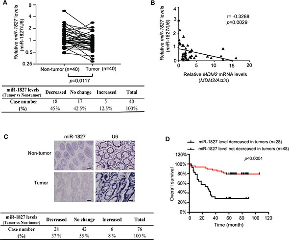 miR-1827 expression is frequently decreased, inversely correlated with MDM2 expression in human colorectal cancer and associated with the poor prognosis of cancer patients.