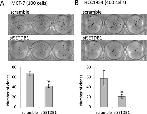 SETDB1 growth-promoting effects in breast cancer cell lines.