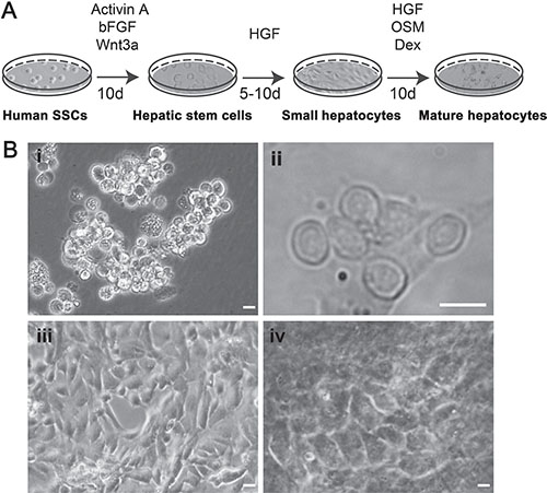 The procedure for transdifferentiation of human SSCs to mature hepatocytes and their morphological features.