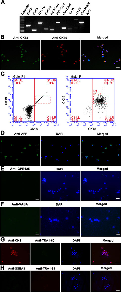 Phenotypic characteristics of transdifferentiation of human SSCs into hepatic stem cells at transcription and translation levels.