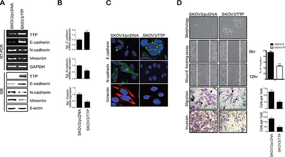 TTP overexpression induces a shift from a mesenchymal to an epithelial phenotype in human cancer cells.