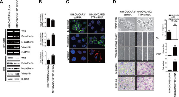 Down-regulation of TTP by siRNA induces a shift from the epithelial to mesenchymal phenotype in human cancer cells.