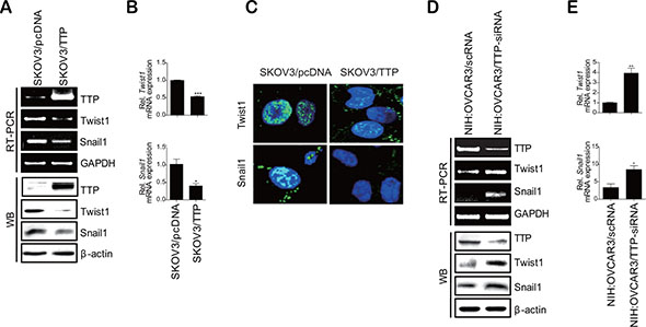 TTP inhibits the expression of Twist1 and Snail1 in human cancer cells.