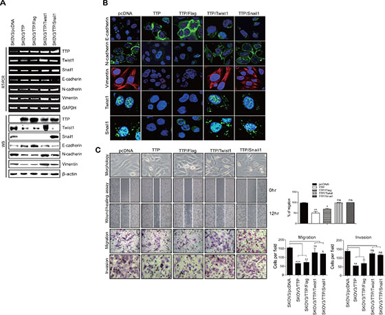 Overexpression of Twist1 or Snail1 cDNA without the 3&#x2032;UTR attenuates the inhibitory effect of TTP on the mesenchymal phenotype.