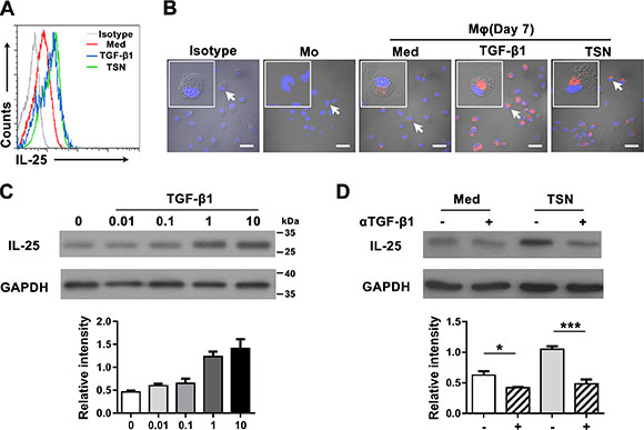 TGF-&#x03B2;1 promotes the production of IL-25 by M&#x03C6;s in gastric cancer tissue.