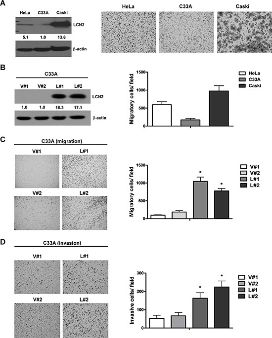 LCN2 promotes cervical cancer cell migration and invasion in vitro.