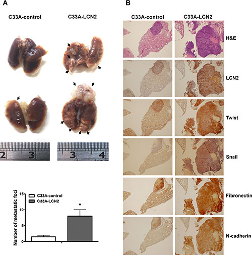 LCN2 promotes cervical cancer cell migration and invasion in vivo.