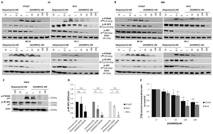 AZD8055 strongly blocks both mTORC1 and mTORC2 signaling pathways and inhibits protein translation in MPNST cell lines.