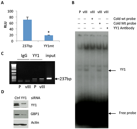 YY1 is involved in regulation of EGFRvIII-mediated GBP1 expression.