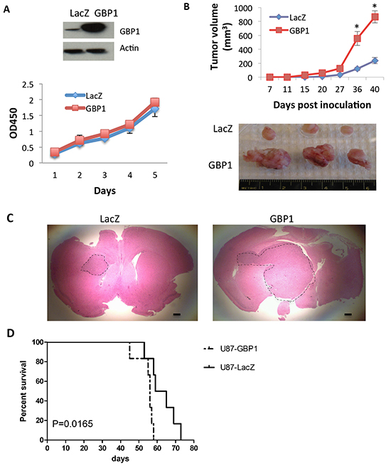 GBP1 overexpression increases glioma tumor growth rate in mice.