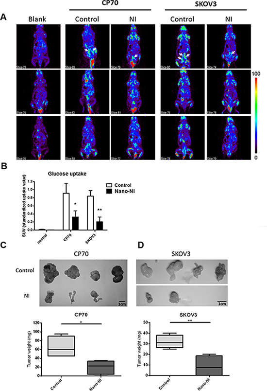 Nano-NI suppressed ovarian cancer tumor growth in NOD/SCID mice.