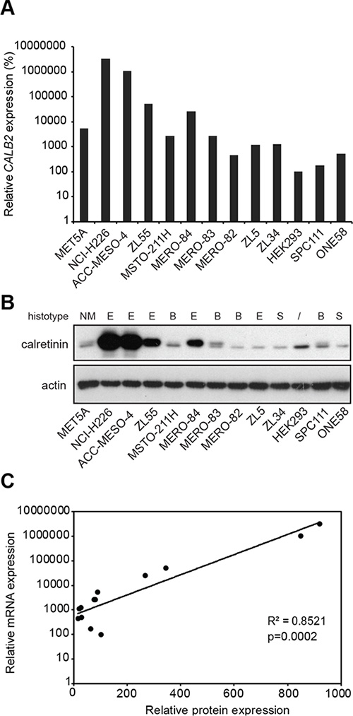 Differential expression of calretinin in a panel of 13 cell lines.