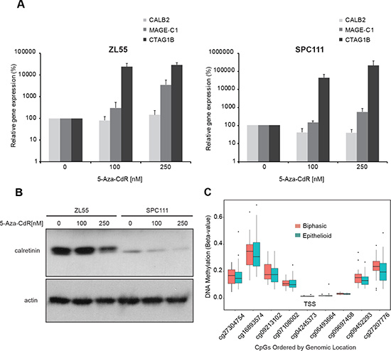 Promoter methylation does not regulate calretinin expression in cell lines and tumor samples.