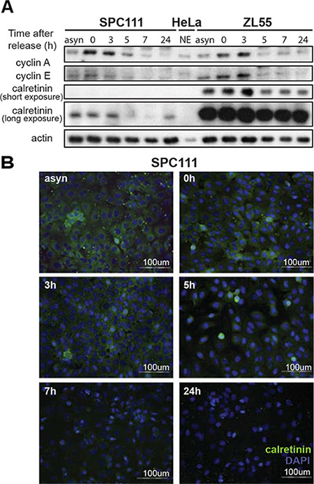 Cell cycle-dependent regulation of calretinin expression.