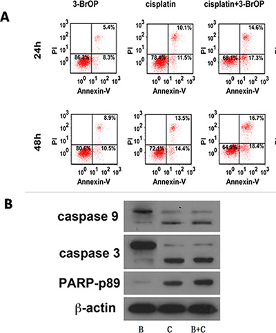 Combination of 3-BrOP and Cisplatin on NPC cells under normoxic and hypoxic conditions.