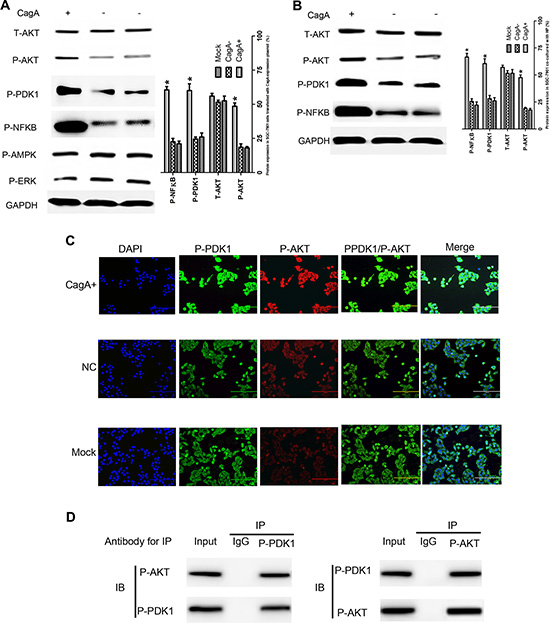CagA activates AKT-NF&#x03BA;B pathway by enhancing the interaction of P-PDK1 and P-AKT.
