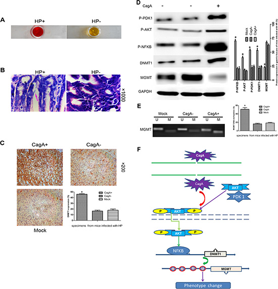 CagA-mediated MGMT hypermethylation and subsequent protein decrease by upregulating DNMT1 via PDK1/AKT-NF&#x03BA;B pathway is recapitulated in vivo.